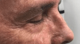 close up of mans face