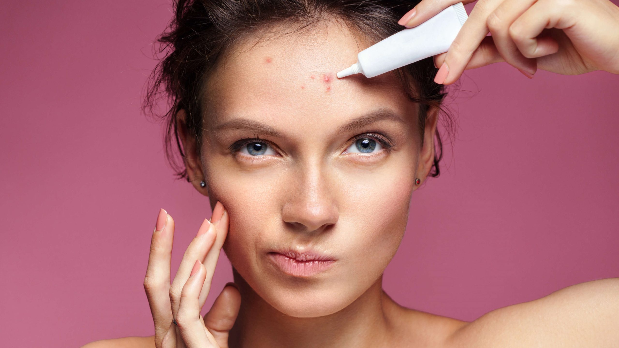 woman applying acne treatment to head